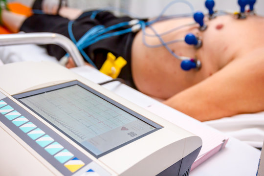 ECG