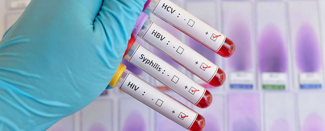 STD Testing