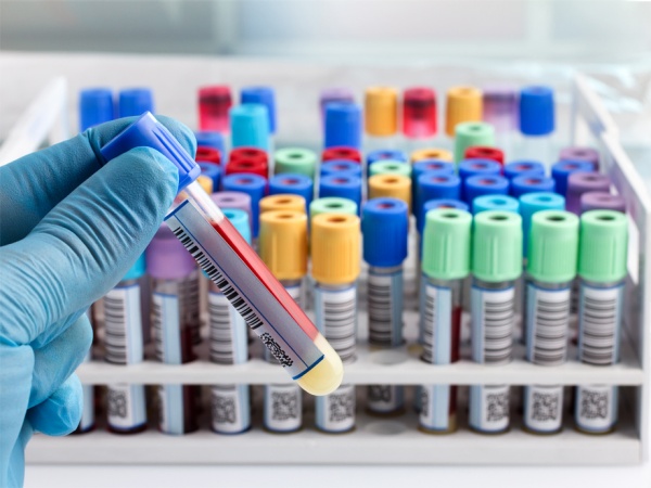 Laboratory Tests